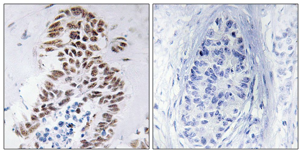 IHC
