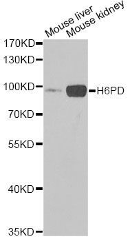 Western blot - H6PD Polyclonal Antibody (144-06440)