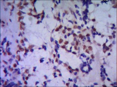 IHC