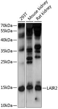 Western blot