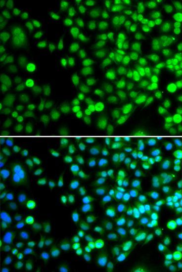 Immunofluorescence - BCAS3 Polyclonal Antibody (144-07274)