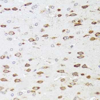Immunohistochemistry - ARHGAP5 Polyclonal Antibody (144-03587)
