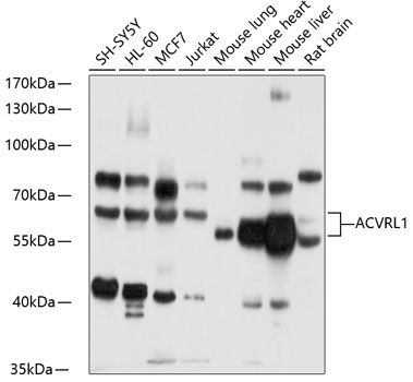 Western blot