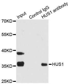 Immunoprecipitation - HUS1 Polyclonal Antibody (144-05407)