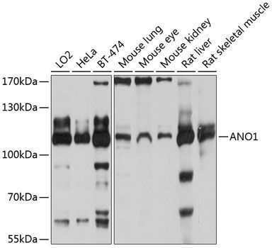 Western blot