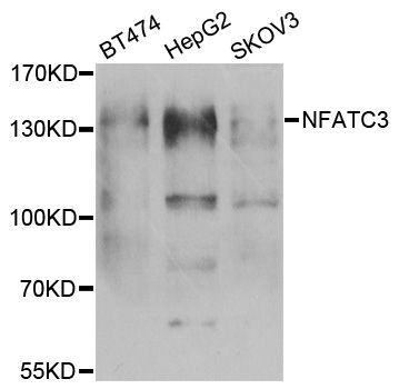 Western blot - NFATC3 antibody (144-06666)