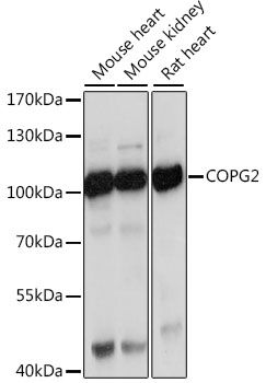 Western blot - COPG2 antibody (144-015817)