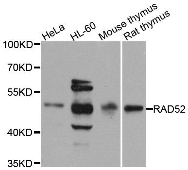 Western blot - RAD52 Polyclonal Antibody (144-03077)