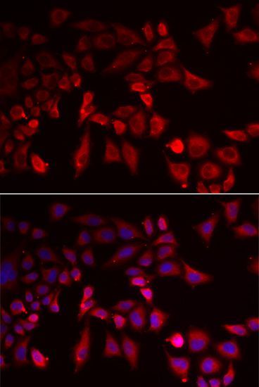 Immunofluorescence - PYGL antibody (144-06710)