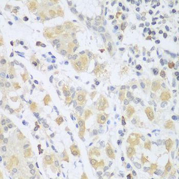 Immunohistochemistry - SGCB antibody (144-06979)