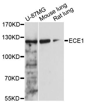 Western blot - ECE1 Polyclonal Antibody (144-05638)