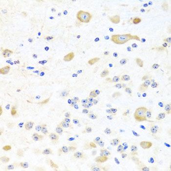 Immunohistochemistry - INPP5K antibody (144-07807)