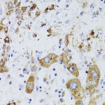 Immunohistochemistry - GATM Polyclonal Antibody (144-06598)