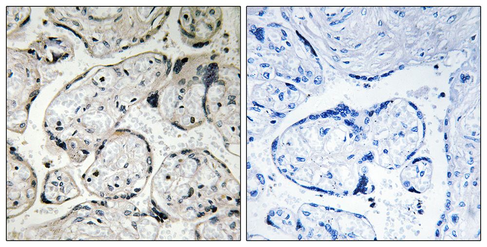 IHC