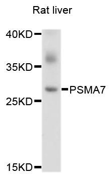 Western blot - PSMA7 antibody (144-04052)