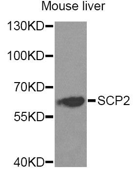 Western blot - SCP2 Antibody (144-05382)