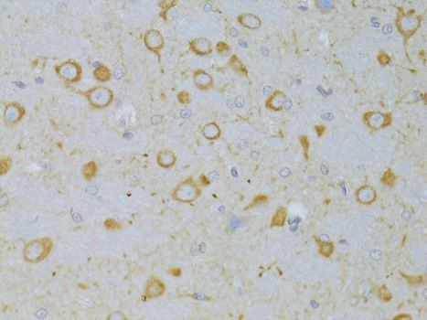 Immunohistochemistry - TSHR Polyclonal Antibody (144-06781)