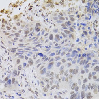 Immunohistochemistry - HDGF Antibody (144-05347)