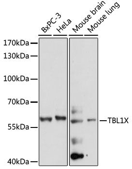 Western blot