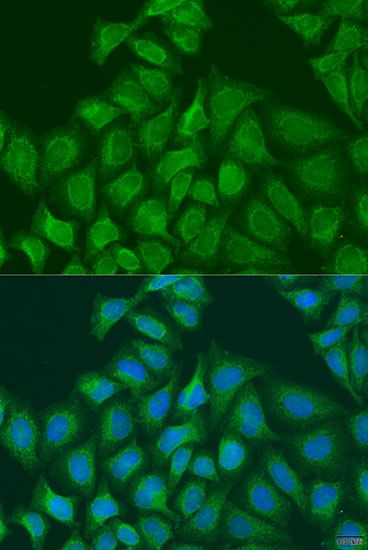 Immunofluorescence - PLOD1 antibody (144-07919)