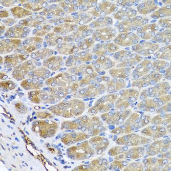 Immunohistochemistry - VPS37A antibody (144-07853)