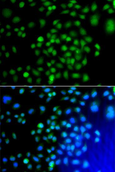 Immunofluorescence - ATF7 antibody (144-07580)