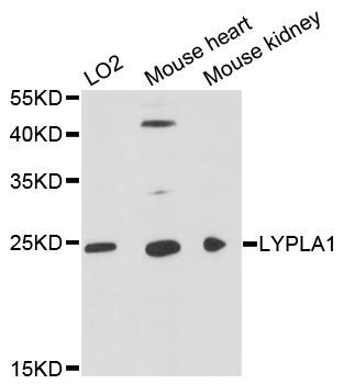 Western blot - LYPLA1 antibody (144-04419)