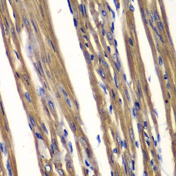 Immunohistochemistry - PTPN2 antibody (144-01808)