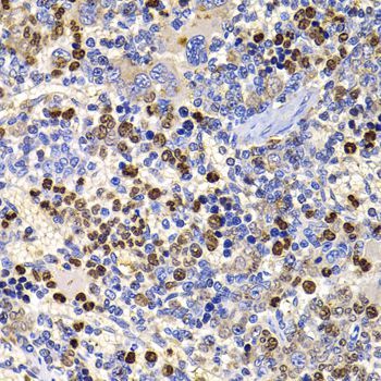 Immunohistochemistry - UBASH3B antibody (144-07141)