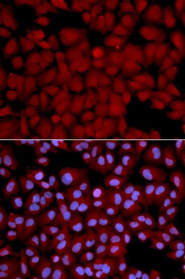 Immunofluorescence - PPP1CB antibody (144-01088)