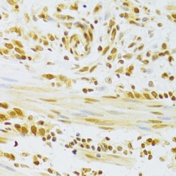 Immunohistochemistry - HMGB1 Polyclonal Antibody (144-02553)