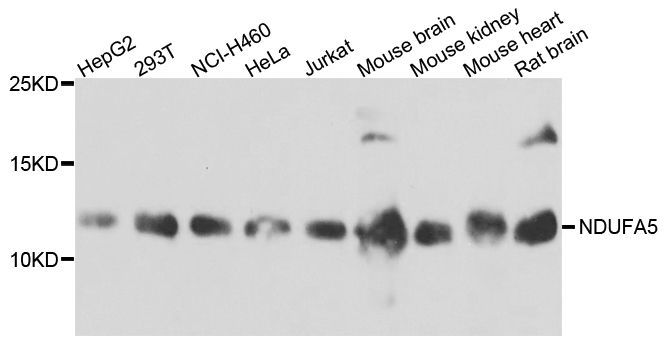 Western blot - NDUFA5 antibody (144-03976)