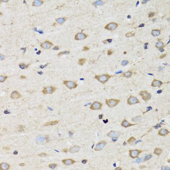 Immunohistochemistry - CLIC4 Polyclonal Antibody (144-07088)