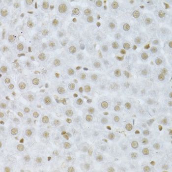 Immunohistochemistry - MAPK3 Polyclonal Antibody (144-00228)