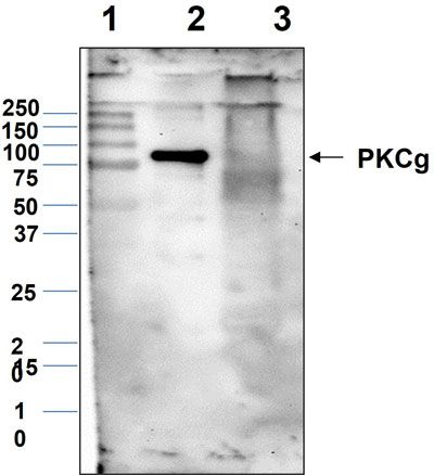 Western blot