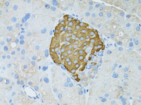 Immunohistochemistry - TEFM Polyclonal Antibody (144-08511)