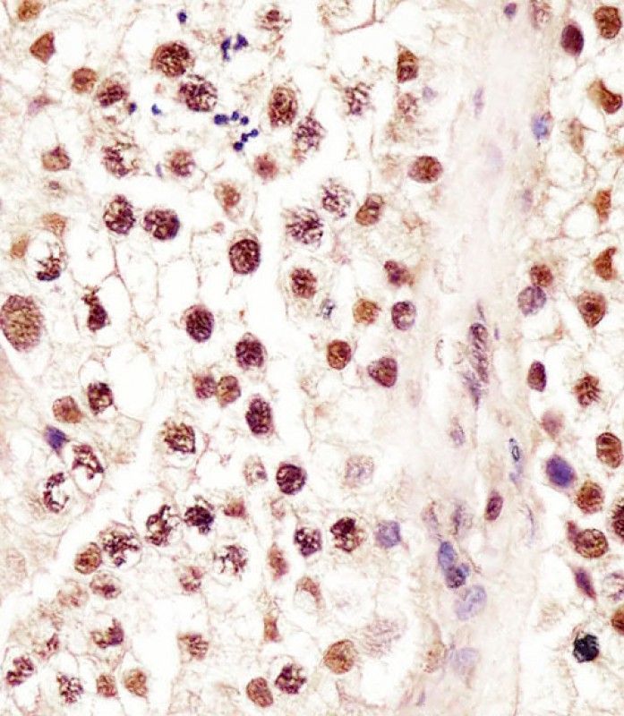 IHC-P