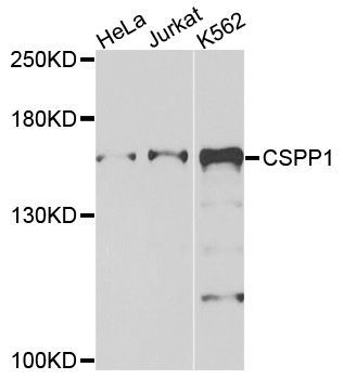 Western blot - CSPP1 antibody (144-09983)