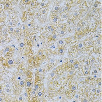 Immunohistochemistry - TNFRSF11B Polyclonal Antibody (144-02100)