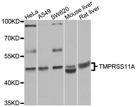 Western blot - TMPRSS11A antibody (144-08605)