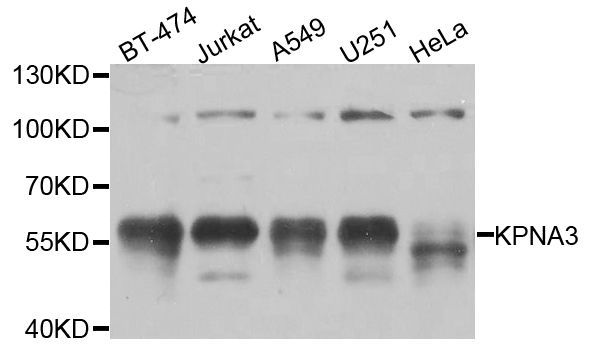 Western blot - KPNA3 antibody (144-08347)