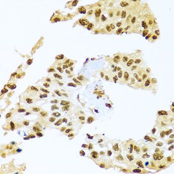 Immunohistochemistry - SMEK1 Polyclonal Antibody (144-08500)
