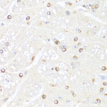 Immunohistochemistry - POLR2B Polyclonal Antibody (144-05928)