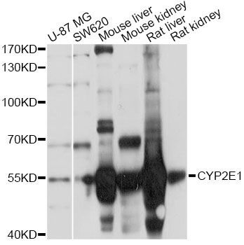 Western blot - CYP2E1 Polyclonal Antibody (144-61331)