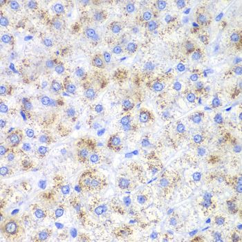 Immunohistochemistry - HAO1 Polyclonal Antibody (144-06470)