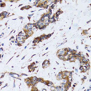 Immunohistochemistry - PGRMC1 antibody (144-05619)