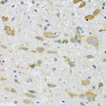 Immunohistochemistry - CCT4 antibody (144-06548)