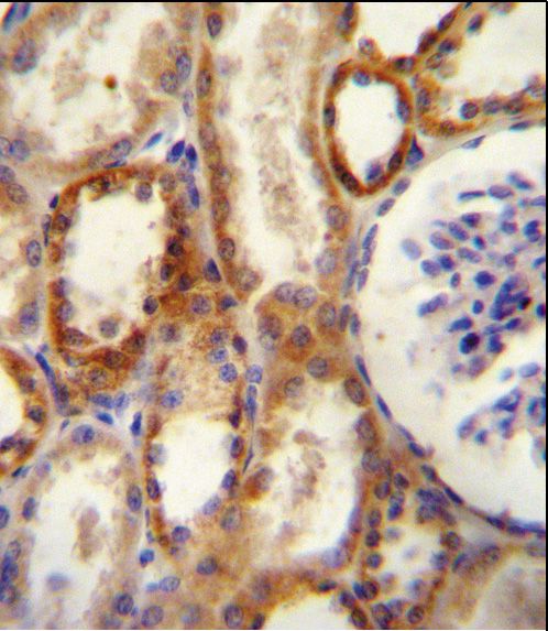 IHC-P