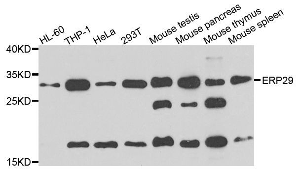 Western blot - [KO Validated] ERP29 Polyclonal Antibody (144-07959)