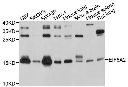 Western blot - EIF5A2 antibody (144-04864)